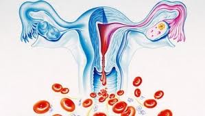 обильные менструации